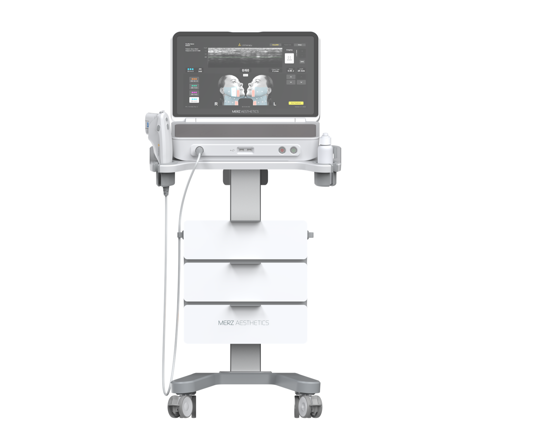 Ultherapy Prime 設備